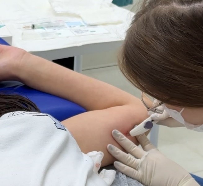 Joaçaba passa a oferecer método contraceptivo de longa duração pelo SUS