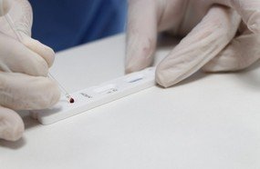 Governo distribui testes rápidos do coronavírus aos municípios