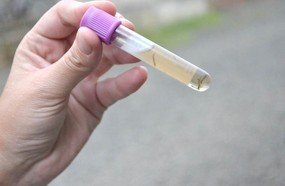 Mais um foco do mosquito da Dengue é encontrado em Capinzal