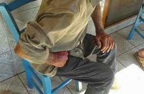 Idoso é covardemente espancado no interior de Campos Novos