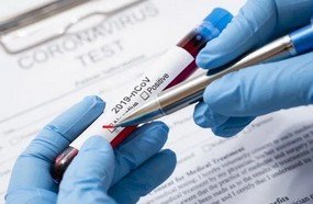 Estado tem 1,8 mil pacientes recuperados de Covid-19