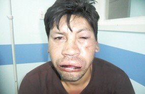 Indígena é assaltado e espancado em Capinzal