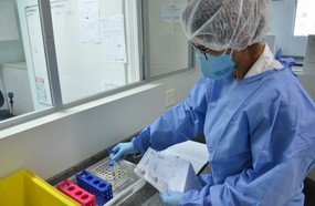 Parceria entre Lacen e Embrapa ampliará testes na região