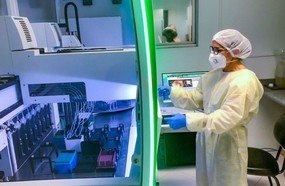 Lacen ultrapassa 110 mil exames para detecção da Covid-19