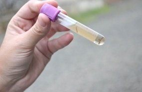 Joaçaba confirma 22 focos do mosquito Aedes Aegypti