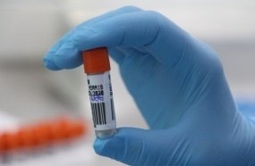 Procon notifica planos de saúde e laboratórios para autorizarem testes de Covid