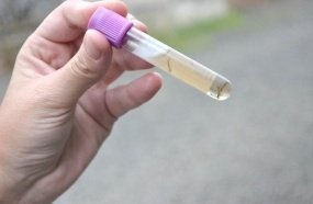 Vigilância encontra larvas do mosquito da dengue em Herval 