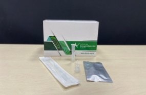 Saúde envia testes rápidos aos municípios para ampliar testagem