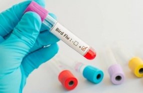 Brasil confirma primeiros casos de gripe aviária em aves silvestres