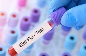 Saúde monitora primeiro caso suspeito de gripe aviária em humano