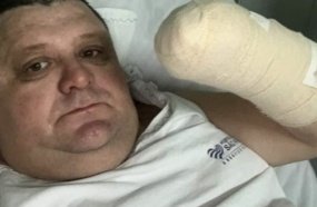Humorista Pilha tem mão amputada após acidente com foguete 