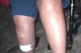 Homem é preso após agredir a mãe cadeirante com cabo de madeira