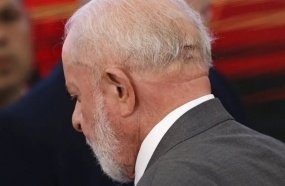Lula passa por cirurgia em São Paulo para drenagem de hematoma 