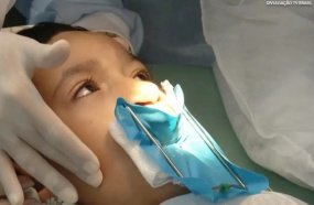 SUS passa a oferecer cirurgia reconstrutiva de lábio leporino 