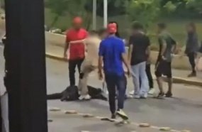 Jovem agredido em Videira passará por cirurgia para reconstrução da mandíbula
