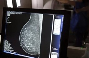 Brasil garante mamografia pelo SUS a mulheres a partir dos 40 anos