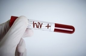 Homem é condenado por transmitir vírus HIV para companheira em SC