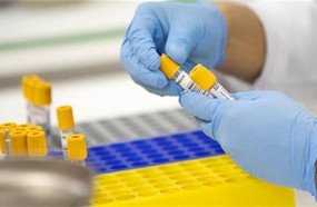 Dois casos de Joaçaba testam negativo para coronavírus