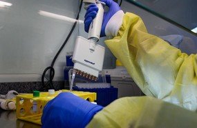 Estado investe em kits para 5,4 mil testes de Covid-19
