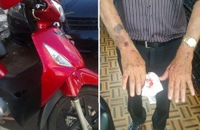 Homem cai de moto por não avistar lombada com pintura apagada