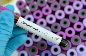 Número de mortes por coronavírus sobe para 34 no país
