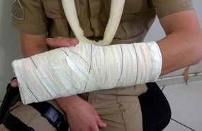 Policial Militar é atingido por facão durante confusão em Fraiburgo